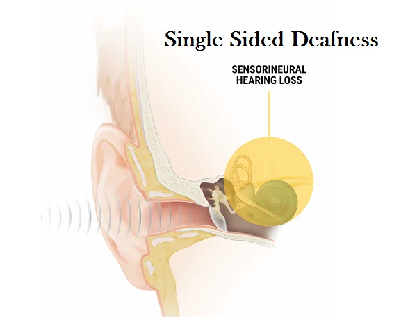 Hearing Health